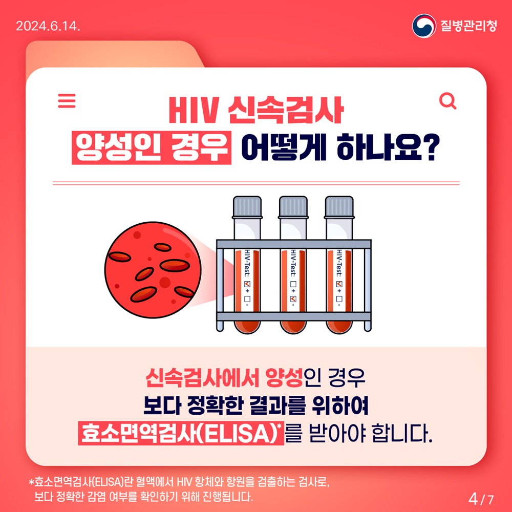 HIV 신속검사 4번째 이미지